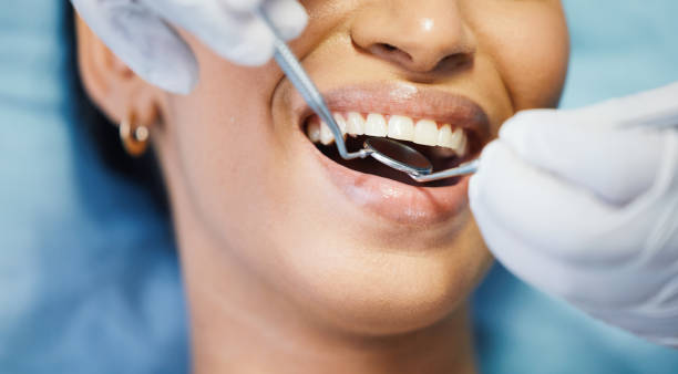 Best Broken or Chipped Tooth Repair in Seaside Heights, NJ